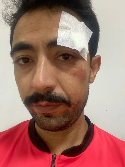 Veteranlar Ligi'nde Hakeme Saldırıya Tepkiler: Lig İptal Edildi